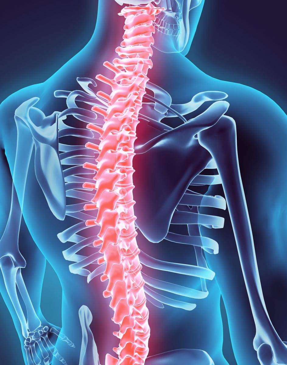 SCI Lawyer Chattanooga | Spinal Cord Injury Attorney