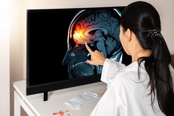 Female Doctor Looking at Scan of Injured Brain (TBI)