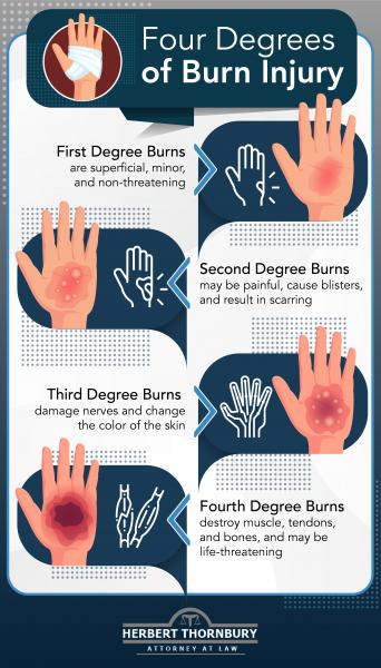 Infographic: Four Degrees of Burn Injury