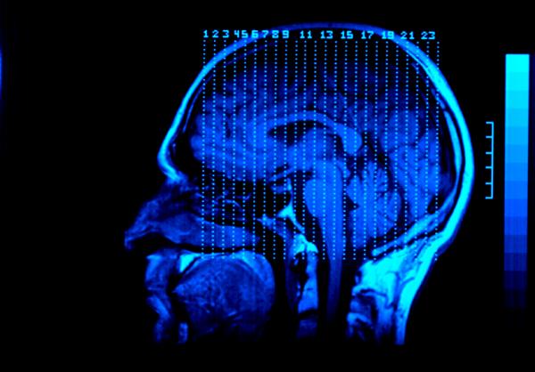 traumatic brain injury in children - Chattanooga